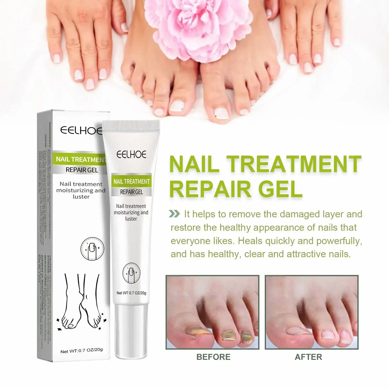 Nail Treatment Repair Gel | Efero Nail Cream for Cracked & Infected Nails – Fast Healing, Hydration & Restoration